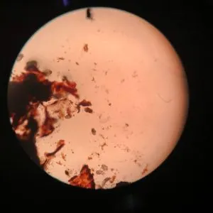 Internal Parasites