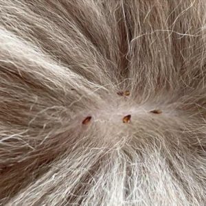 Are Cat Fleas Dangerous To Humans